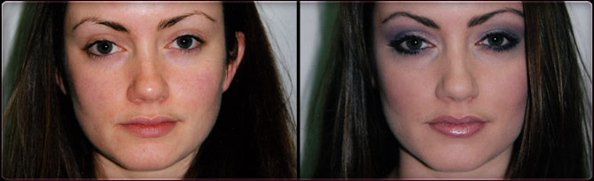 before and after 02