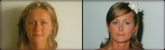 before and after 03